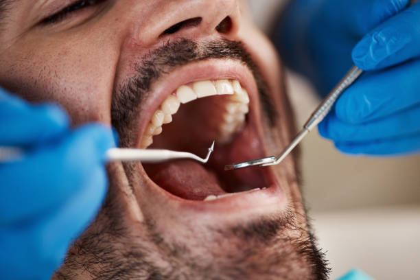 Professional Emergency Dentist in MD